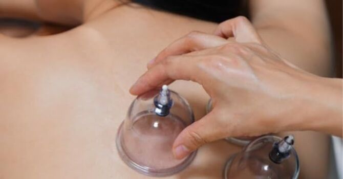 60 MIN CUPPING MASSAGE